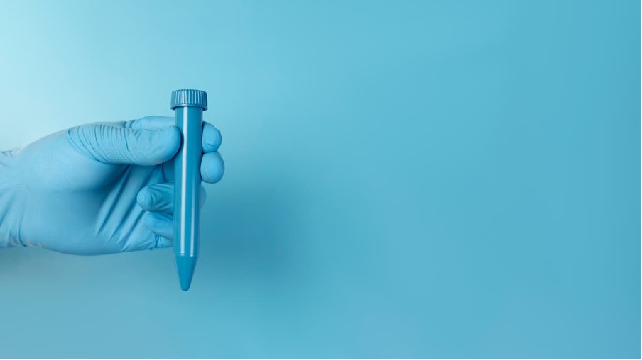 Muestra de tejido testicular