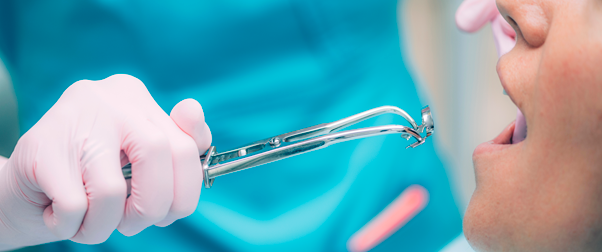 Endodoncia Tratamientos Odontología