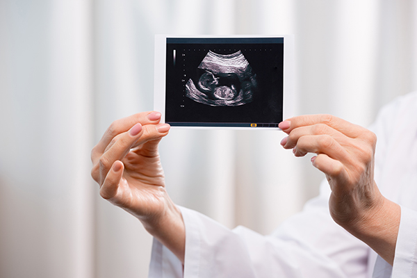 ecografía embarazo hm fertility center