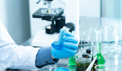 laboratory. hand holding a flask. microscope on the background.